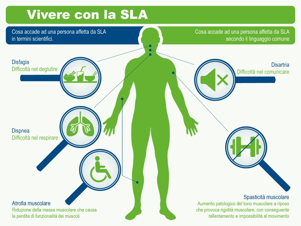 Sla