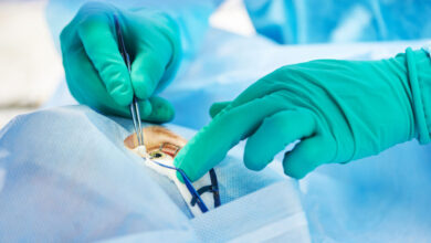 Centro oculistico Pollio