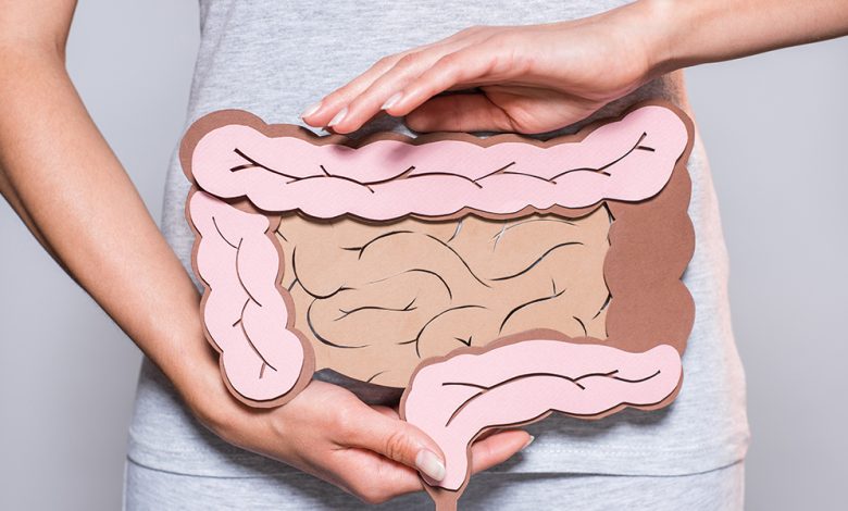 Cancro del colon retto