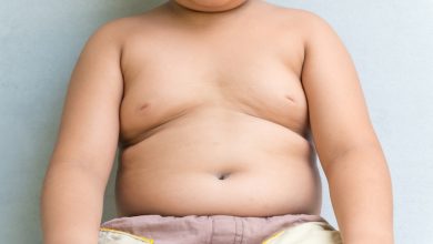 obesità infantile