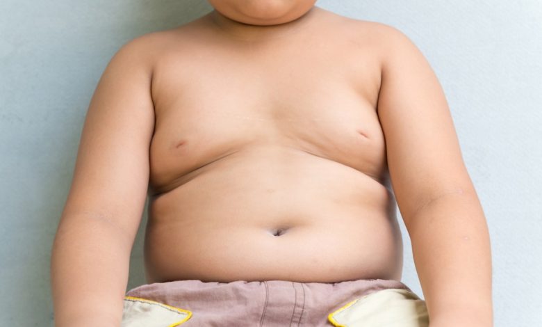 obesità infantile