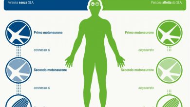 Società Italiana di Neurologia
