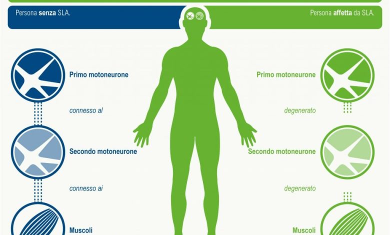 Società Italiana di Neurologia