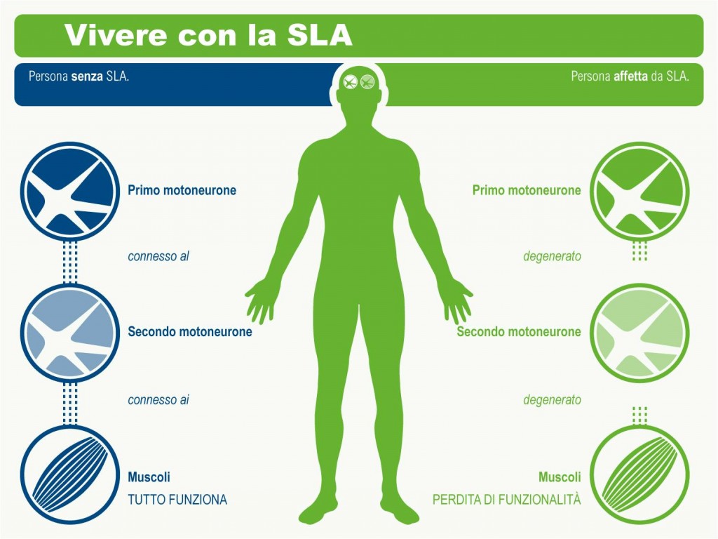 Società Italiana di Neurologia